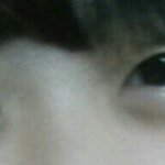 [도와주세요] 쌍수 헤야되나요ㅠㅠㅠㅠㅠㅠㅠ??