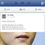 [EXO] 헐나만루한입<b>흉터</b>있는거 몰랐음...ㅠ?