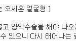 [EXO] 성형외과 <b>의사</b>가 말한 세훈이 얼굴형