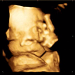 [답변부탇] 태아도 낯을 가리나요?ㅎㅎ