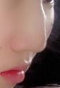 [성형] 코수술해야겠죠?