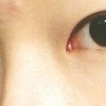 [댓글부탁] <b>속</b>쌍꺼풀 <b>눈</b>.. 어때요?ㅠㅠ