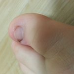 [조언부탁] <b>발톱</b>이 이상해요