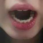 [댓글부탁] <b>치아</b>좀봐주세요