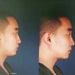[댓글부탁] 성형한거 이상함??