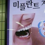 [EXO] 백현이 치과모델광고찍음
