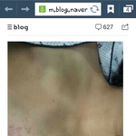 <b>지적</b>장애 2급 여자를 강금 폭행 했대요.