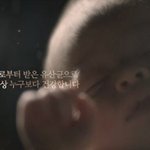 [유산균] 몸에 좋은 프로바이오틱스 유산균 <b>세븐</b>!