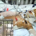 [공포베스트] 아파트 11층에서 떨어진 후 살아난 기적의 아기