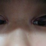[봐주세요] [<b>혐오</b>주의]심한가요?????