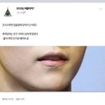 [EXO] 루한이입술상처 썰품