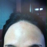 꽃다운 슴셋의 헤어라인 왁<b>싱</b>후기............