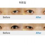 [EXO] 여기<b>쌍</b><b>수개</b>잘하네 병원어딘지아는사람?