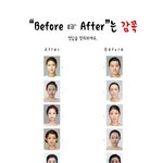 <b>성형</b> 전/<b>후</b> 알아맞추기