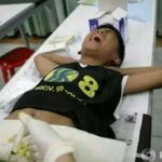 포경수술하다가 웅변대회 1등한 썰