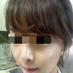 물광보톡스 맞고 왔어요~ 물광보톡스 효과 <b>짱짱</b>!