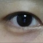 [조언부탁] <b>사진o</b>)남자.. 쌍수해야할까요?