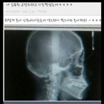 [EXO] 장동우 걔 <b>엑스레이</b>찍으면 이렇게될듯