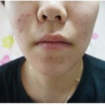 트러블에 좋은 비누 추천_ 얼굴에 직접 사용하는 비오템 해초모공비누