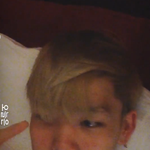 [BAP] <b>어택</b> 주농이 피부ㅠㅠ