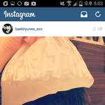 [백현] 백현이 인스타 업뎃!!머리에 혹난 <b>멍뭉이</b>