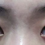 제 눈이 어떤지 좀 봐주세요