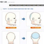[추억파리여] 뒤통수 <b>성형</b>ㄷㄷ