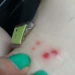 [꼭봐주세요] (사진有)신발쇼핑몰에서 산 신발..상처.ㅠㅠ