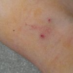 [꼭봐주세요] 헌혈하다  줄끊어진썰(사진o)