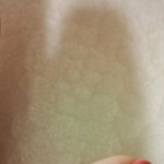 [조언부탁] <b>사마귀</b>뭐가제일안아파요ㅜ(혐오주의)