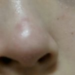 [알려주세요] 피부<b>착색</b> ㅠㅠ