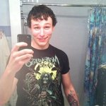 [공포베스트] <b>염색약</b> 알레르기로 얼굴이망가진 남자