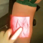 [피씨<b>레몬</b>] 미래에 도입 예정인 주사 방식