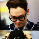 [EXO] 첸 종대 <b>탈모</b> 