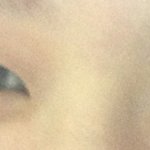 눈좀 봐주세요... 쌍수해야할까요?