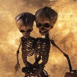 [<b>공포</b>베스트] 1800년대 샴 쌍둥이의 유골