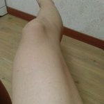 다리가 움푹<b>해요</b>