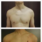 [소<b>오름</b>] 요즘 남자들이 하는 성형