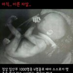 [공미니] 천명 중 4명꼴로 나타난다는 <b>태아</b>의 자살