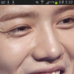 [EXO] 루한 <b>누렁</b>니 앞니두개