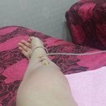 양재역피부과 주사사고, <b>혈관</b> 약하면 원래 이렇게 되나요?