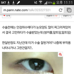 [EXO] 개인적으로 이 <b>쌍수</b>후기가 짱인듯