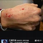 [추억파리여] 후쿠시마의 위험성ㄷㄷ