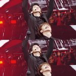 [EXO] 변백현<b>양악</b>수술증거;;