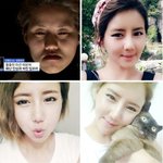 렛미인4 웃음을 잃어버린 딸 윤<b>단비</b>씨의 대박 변신