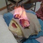 [소<b>오름</b>] 중국의 엽기 피부관리법