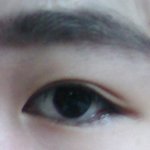 [댓글부탁] 눈이 부었는데 붓기가 안빠져요ㅜ사진있음!
