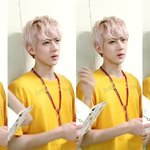 [EXO] 세훈이 함ㅋㅋㄱㄱ성형이던 <b>시술</b>이던