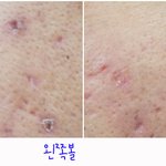 늘어진 모공, 샘솟는 피지가 싫다!  비오템퓨어펙트 사용기