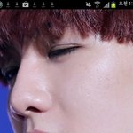 [EXO] 이거 쌍수<b>자국</b>이야..?